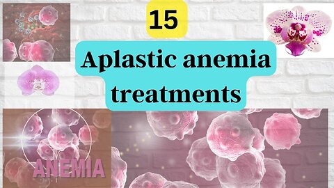 15 Aplastic anemia treatments