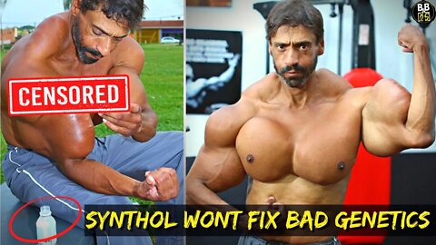 How Synthol Took Valdir Segato LIFE