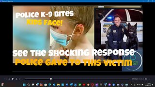 Kid gets bit in the face by police K-9 dog! and the shocking response of the police department