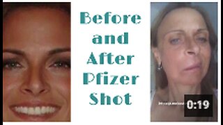 Before and After Pfizer Shot