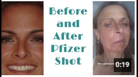 Before and After Pfizer Shot