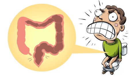 How to Get Rid of Constipation Quickly and Naturally