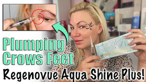 Plumping Crows Feet with Regenovue Aqua Shine Plus, AceCosm | Code Jessica10 Saves you Money