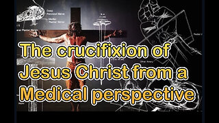 Crucifixion of Jesus from a medical perspective