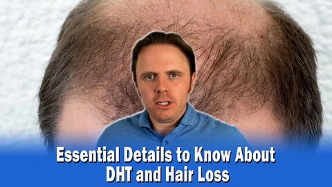 Essential Details to Know About DHT and Hair Loss