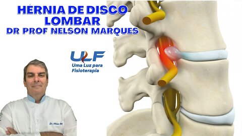 HÉRNIA DE DISCO LOMBAR - Dr. Prof. Nelson Marques