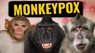 Monkeypox | What You Need To Know