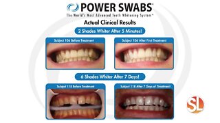 Want to look younger, healthier? Try Power Swabs Teeth Whitening