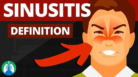 What is Sinusitis? (Medical Definition)