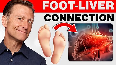 How Your Feet Are Warning You About Your Liver Problems - Dr. Bergs Advice
