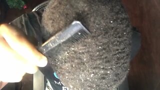 Psoriasis Dandruff Removal with Curly Hair