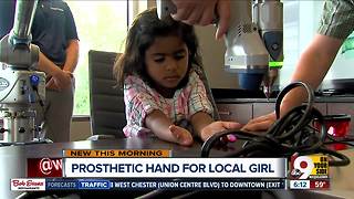 Lakota East students' senior project: Build a prosthetic hand for 4-year-old girl