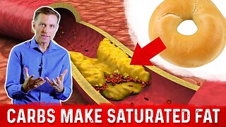 Dangerous Cholesterol Is Coming From Carbs, Not Fat! – Dr.Berg On Cholesterol Causes & Saturated Fat