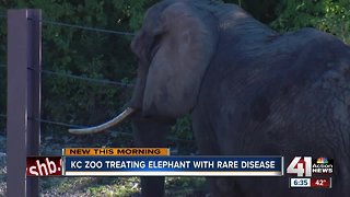 Kansas City Zoo elephant first to be diagnosed with disease common to humans