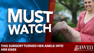 This Surgery Turned Her Ankle into Her Knee