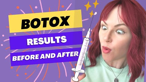 Botox Results with Before and After Pictures