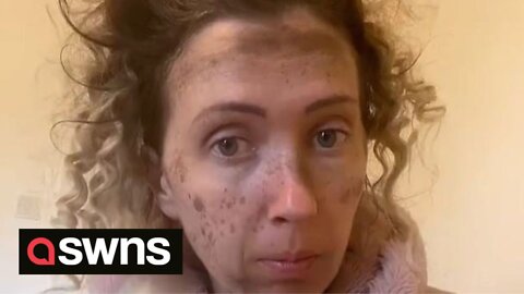 UK mum copies fake freckles trend but was left looking like she 'stuck her head up a chimney'