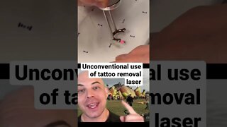 Doctor explains laser demonstration!