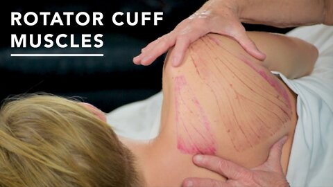 How to treat frozen shoulder: Massage video with Maria Natera