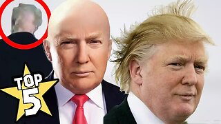 TOP 5 | DONALD TRUMP'S BALD SPOT SHOCKING FACTS