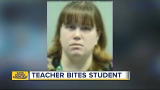 Preschool teacher accused of biting 2-year-old's face