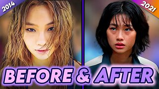 HoYeon Jung | Before & After | Squid Game Star Plastic Surgery Transformation & More