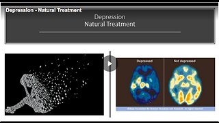 Know more about natural treatments for depression