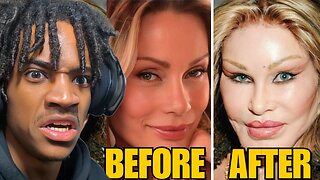 10 Plastic Surgeries That Went HORRIBLY Wrong...