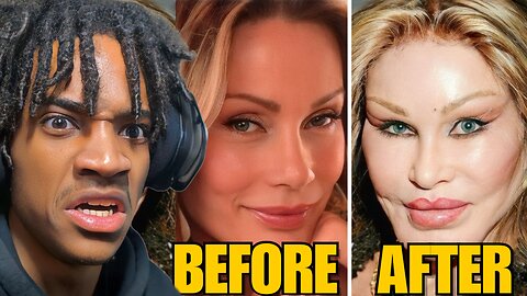 10 Plastic Surgeries That Went HORRIBLY Wrong...