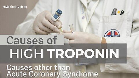 Troponin - Causes of Raised of high Troponin in Non-ischemic chest pains