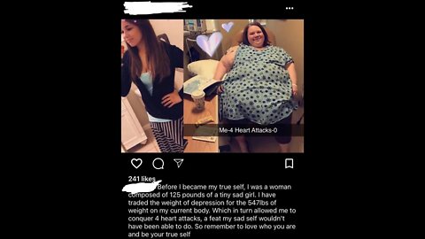 Woman Gained 547 Pounds To Be HAPPY #bodypositivity