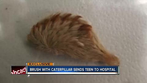 Venomous caterpillar sends Land O' Lakes boy to ER; mom warning others