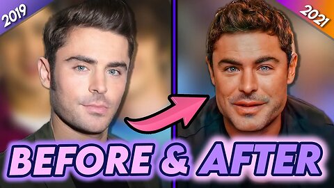 Zac Efron | Before & After | Why He REALLY Got Plastic Surgery?