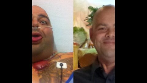 Episode 94: Thyroid Cancer, Lung Cancer, 39 Surgeries and Massive Weight Gain