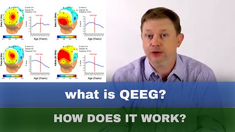 QEEG & s-LORETA Brain Mapping Basics Explained