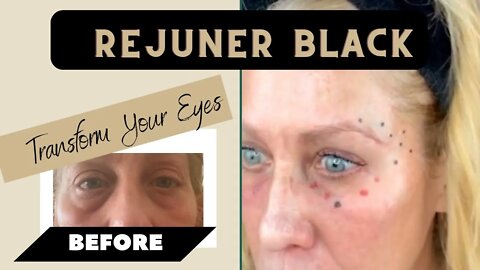 Rejuner Black Strong Collagen Stimulator -Eyes, Temples and Brow Area