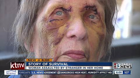 80-year-old assault victim shares story of survival