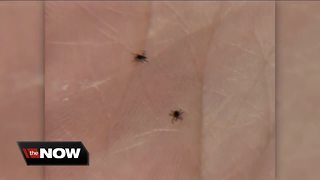 WI is the 4th-worst state for Lyme disease in US