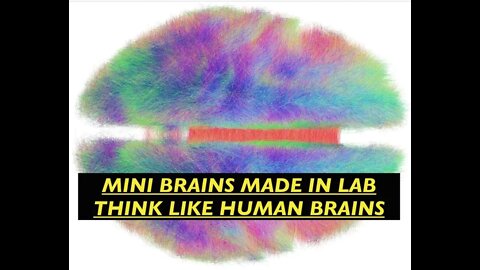 Scientists Created Mini Brains with Stem Cells From Skin That Think Like Human Brains