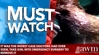 It Was The Worst Case Doctors Had Ever Seen, Take Girl Into Emergency Surgery To Remove It