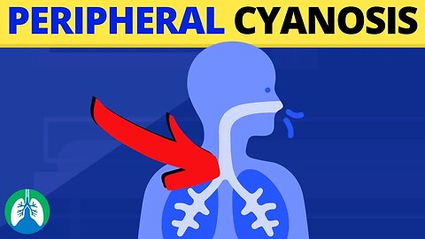 Peripheral Cyanosis (Medical Definition) | Quick Explainer Video