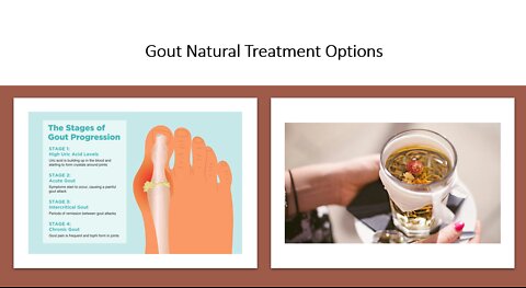 Gout - Natural Treatment Options