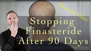 Stopping Finasteride After 90 Days - Live Stream Reaction