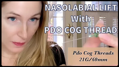 Cog Pdo Threads DIY Nasolabial fold
