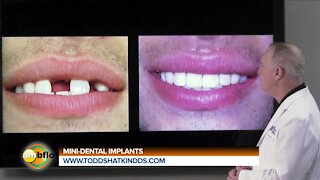 DR. TODD SHATKIN - MINI IMPLANTS