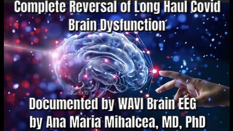 Complete Reversal of Long Haul Covid Brain Dysfunction as documented by WAVI Brain EEG