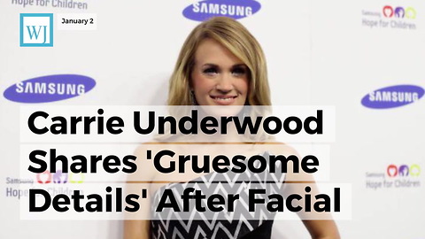 Carrie Underwood Shares 'Gruesome Details' After Facial Injury 'Between 40 And 50 Stitches'