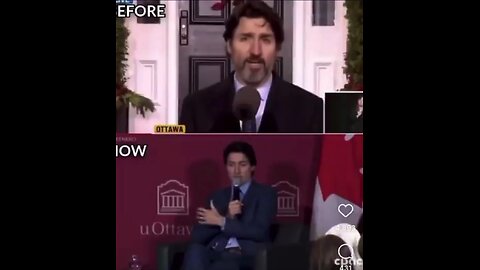 Justin Castro Trudeau on vaccinations 💉 then and now