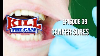 Canker Sores - The Kill The Can Podcast Episode 39