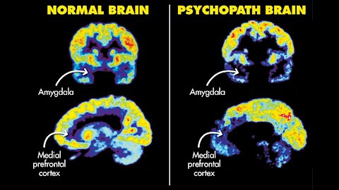 Paths of Psycho